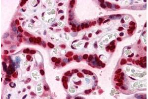 anti-High Mobility Group Box 2 (HMGB2) (AA 1-196) antibody