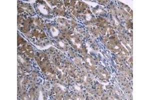 DAB staining on IHC-P; Samples: Human Stomach Tissue (APOA1 anticorps  (AA 122-267))