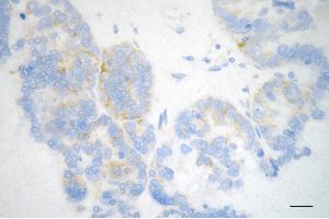 anti-Musashi Homolog 2 (MSI2) antibody
