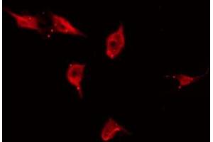 anti-Tumor Protein P53 Inducible Protein 11 (TP53I11) (N-Term) antibody