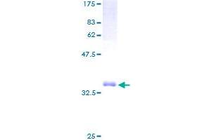 Image no. 1 for T-Cell Leukemia Translocation Altered (TCTA) (AA 1-103) protein (GST tag) (ABIN1322419)