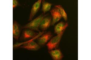 anti-Glyoxalase I (GLO1) (AA 2-184) antibody