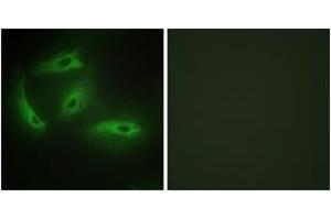 Immunofluorescence analysis of HeLa cells, using CDKL4 Antibody. (CDKL4 anticorps  (AA 266-315))