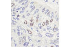 Immunohistochemistry (IHC) image for anti-Topo IIalpha (C-Term) antibody (ABIN7454588) (Topo IIalpha (C-Term) anticorps)