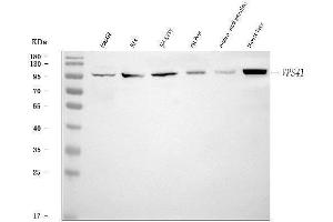 Western blot analysis of VPS41 using anti-VPS41 antibody (ABIN7601748).