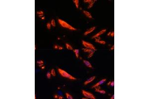 Immunofluorescence analysis of U-2 OS cells using LRRC7 antibody (ABIN6128203, ABIN6143347, ABIN6143348 and ABIN6216986) at dilution of 1:100. (LRRC7 anticorps  (AA 730-890))
