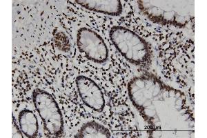 Immunoperoxidase of monoclonal antibody to CD3EAP on formalin-fixed paraffin-embedded human small Intestine.