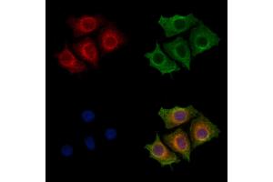 ABIN7094366 and ABIN7098413 staining HepG2 cells by IF/ICC. (KIAA0391 anticorps  (Internal Region))