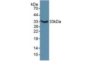Western blot analysis of recombinant Mouse MAP6. (MAP6 anticorps  (AA 177-387))