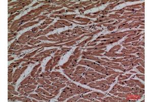 Immunohistochemistry (IHC) analysis of paraffin-embedded Human Heart, antibody was diluted at 1:100.