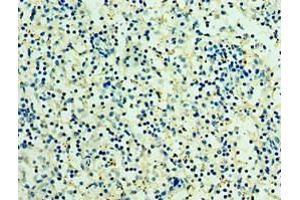 Immunohistochemistry of paraffin-embedded human spleen tissue using ABIN7166935 at dilution of 1:100 (RSPO1 anticorps  (AA 21-263))