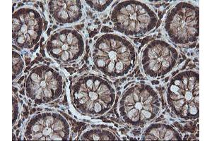 Image no. 1 for anti-Chaperonin Containing TCP1, Subunit 8 (Theta)-Like 2 (CCT8L2) antibody (ABIN1497480)