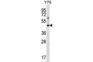 IFNGR1 Antibody (C-term) western blot analysis in Y79 cell line lysates (35µg/lane). (IFNGR1 anticorps  (C-Term))