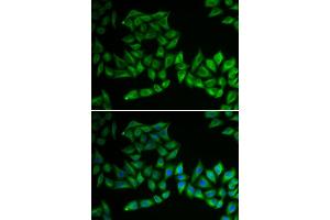 Immunofluorescence analysis of U2OS cells using TPMT antibody . (TPMT anticorps  (AA 1-245))