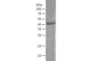 Medium-Chain Specific Acyl-CoA Dehydrogenase, Mitochondrial (MCAD) (AA 26-421) protein (His-IF2DI Tag)