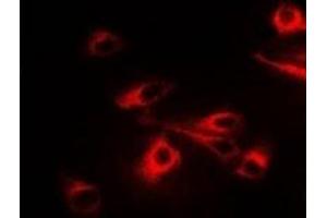 Immunofluorescent analysis of CCT2 staining in A549 cells. (CCT2 anticorps)