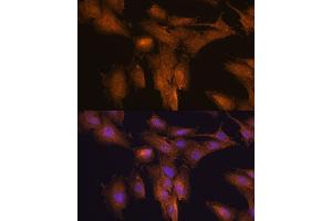 Immunofluorescence analysis of C6 cells using TSLP antibody (ABIN6128843, ABIN6149624, ABIN6149626 and ABIN6217014) at dilution of 1:100.