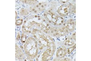 Immunohistochemistry of paraffin-embedded rat kidney using TPI1 antibody (ABIN7270977) at dilution of 1:100 (40x lens).