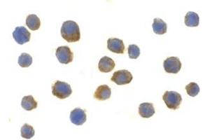 Immunocytochemistry of TLR9 in Jurkat cells with this product at 2 μg/ml. (TLR9 anticorps  (Center))