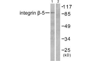 Western blot analysis of extracts from COS7 cells, using Integrin beta 5 antibody (ABIN5976431).