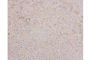 IHC analysis of HSPD1 using anti-HSPD1 antibody (ABIN7600976). (HSPD1 anticorps  (AA 260-496))