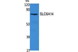 Western Blotting (WB) image for anti-Solute Carrier Family 6 (Amino Acid Transporter), Member 14 (Slc6a14) (C-Term) antibody (ABIN3187658) (Slc6a14 anticorps  (C-Term))