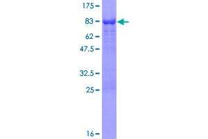 Image no. 1 for AP2 associated kinase 1 (AAK1) (AA 1-474) protein (GST tag) (ABIN1305395)