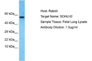 Host: Rabbit Target Name: SOHLH2 Sample Type: Fetal Lung lysates Antibody Dilution: 1. (SOHLH2 anticorps  (N-Term))