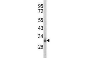 Western blot analysis of Olig3 antibody and mouse spleen tissue lysate