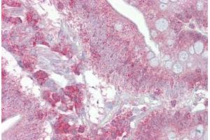 Anti-PSEN1 / Presenilin 1 antibody IHC staining of human small intestine.