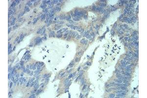 Immunohistochemistry (IHC) image for anti-Methyl CpG Binding Protein 2 (MECP2) (AA 7-148) antibody (ABIN5889789) (MECP2 anticorps  (AA 7-148))