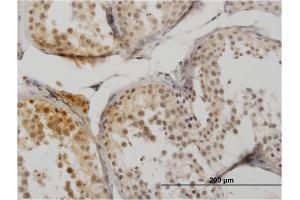 Immunoperoxidase of monoclonal antibody to SUMO1 on formalin-fixed paraffin-embedded human testis. (SUMO1 anticorps  (AA 1-101))