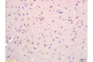 Formalin-fixed and paraffin embedded rat brain labeled with Rabbit Anti EphA2/Eph receptor A2 Polyclonal Antibody, Unconjugated (ABIN669201) at 1:200 followed by conjugation to the secondary antibody and DAB staining (EPH Receptor A2 anticorps  (AA 901-976))