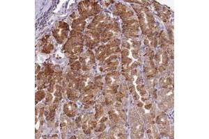 Immunohistochemical staining of human stomach with SCAF1 polyclonal antibody  shows strong cytiplasmic positivity in glandular cells at 1:50-1:200 dilution. (SCAF1 anticorps)