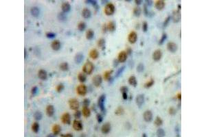 IHC-P analysis of Kidney Tissue, with DAB staining. (HMGB1 anticorps  (AA 1-215))