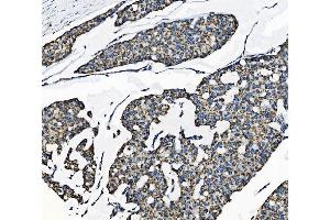 IHC analysis of TOMM70 using anti-TOMM70 antibody (ABIN7599855). (TOM70 anticorps  (AA 122-608))