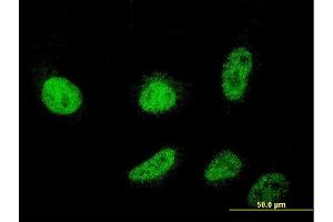 Immunofluorescence of monoclonal antibody to CSDC2 on HeLa cell. (CSDC2 anticorps  (AA 1-153))
