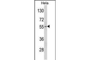 Western blot analysis of DFNA5 Antibody in Hela cell line lysates (35ug/lane) (DFNA5 anticorps  (N-Term))