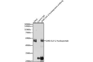 Immunoprecipitation analysis of 300 μg extracts of 293T cells using 3 μg SARS-CoV-2 Nucleoprotein antibody (ABIN7269053). (SARS-CoV-2 Envelope anticorps)