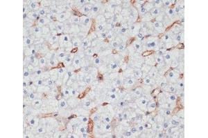 Immunohistochemistry of paraffin-embedded Human liver using CD36 Polyclonal Antibody at dilution of 1:200 (40x lens). (CD36 anticorps)