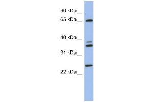 WB Suggested Anti-ATP6V1A Antibody Titration: 0. (ATP6V1A anticorps  (N-Term))