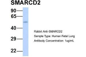 Host:  Rabbit  Target Name:  SMARCD2  Sample Type:  Human Fetal Lung  Antibody Dilution:  1. (SMARCD2 anticorps  (Middle Region))