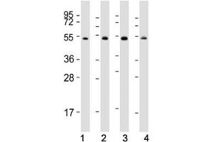 Western blot testing of human 1) Raji, 2) K562, 3) Jurkat and 4) HeLa cell lysate with HSP60 antibody.