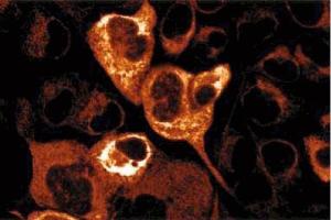 Immunofluorescence staining of A431 cells. (Kalinin B1 (AA 1009-1170) anticorps)
