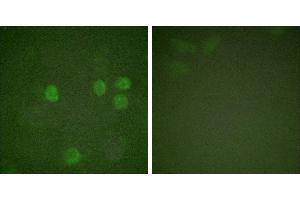 Forskolin + -Immunofluorescence analysis of HeLa cells, treated with Forskolin (40nM, 30mins), using Cyclin B1 (Ab-126) antibody (#BOO68). (Cyclin B1 anticorps  (Ser126))