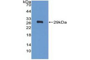 Detection of Recombinant PDGFRa, Human using Polyclonal Antibody to Platelet Derived Growth Factor Receptor Alpha (PDGFRa) (PDGFRA anticorps  (AA 170-387))