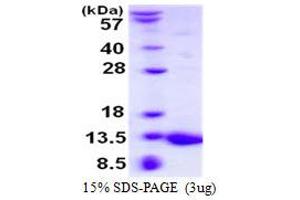 Image no. 1 for S100 Calcium Binding Protein A5 (S100A5) protein (His tag) (ABIN1098260) (S100A5 Protein (His tag))
