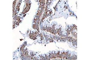 IHC analysis of PPA2 using anti-PPA2 antibody (ABIN6719431). (PPA2 anticorps  (AA 33-334))