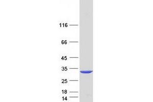 Validation with Western Blot