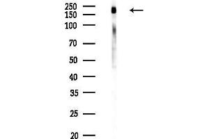 Western blot analysis of lysates from K562 cells(UV,30 min treatment), using Phospho-NMDAR2B (Ser1284) Antibody at 1/1000 dilution.